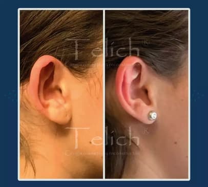 Slider image (9) Dr. Jose E. Telich - Plastic Surgeon